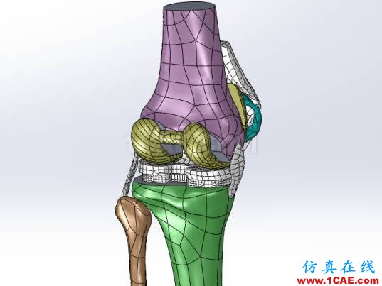 【醫(yī)學(xué)應(yīng)用】骨科知識(shí)和有限元分析ansys圖片4